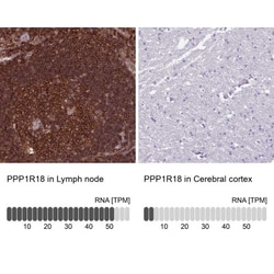 PPP1R18 Antibody, Novus Biologicals 0.1mL; Unlabeled:Antibodies, Polyclonal